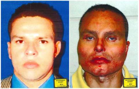 Juan Carlos Ramírez before and after plastic surgeries
